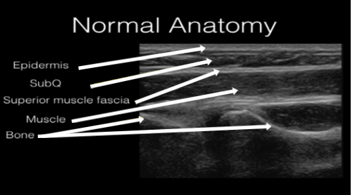 Figure 1 - Normal Anatomy labeled copy.jpg